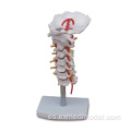 Columna vertebral cervical con arteria del cuello